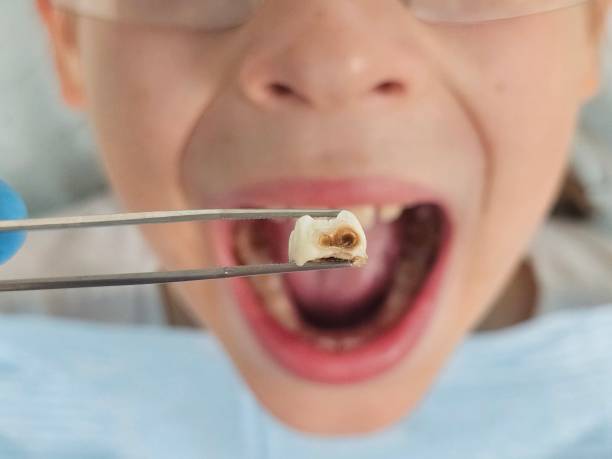 Best Emergency Dental Surgery in Edna, TX