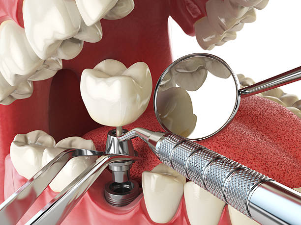 Best Emergency Dental Care for Trauma or Injury in Edna, TX
